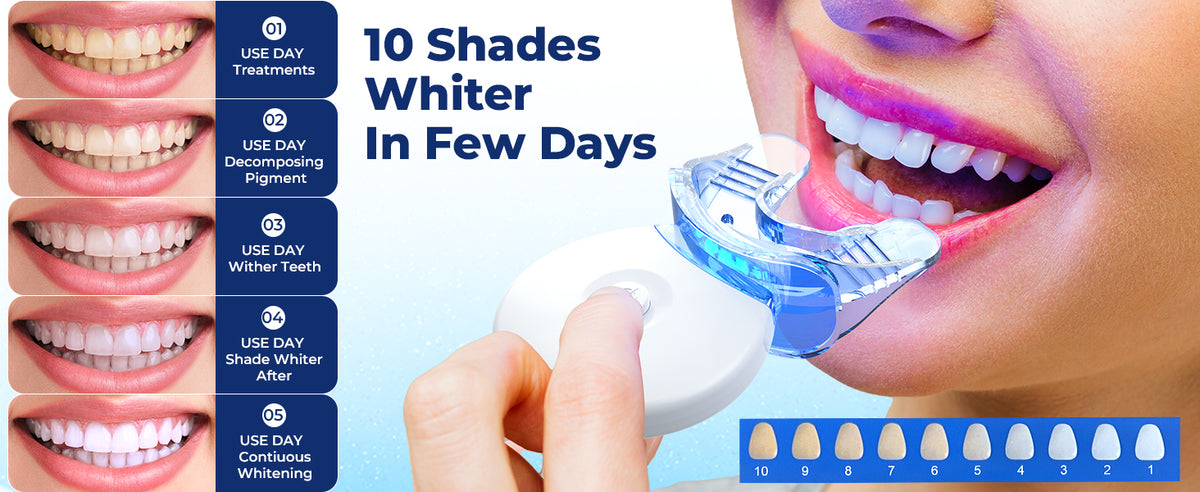 SMILEKIT - Professionelles Zahnaufhellungs-Kit