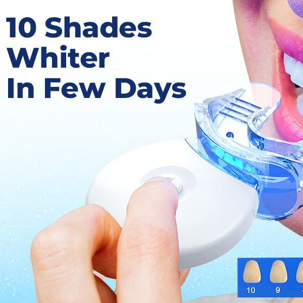 SMILEKIT - Professionelles Zahnaufhellungs-Kit